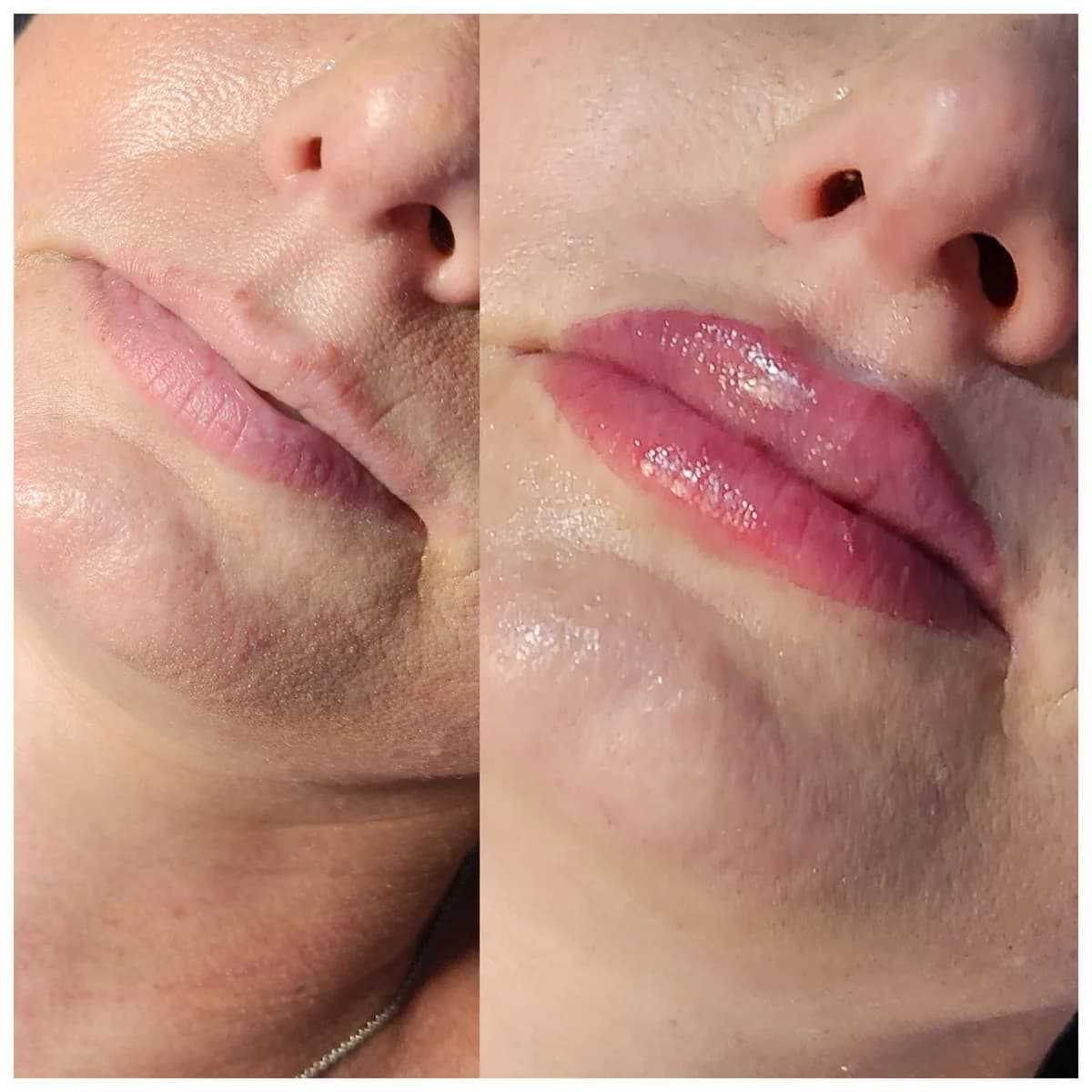 Before and after: Healed · Lip blush