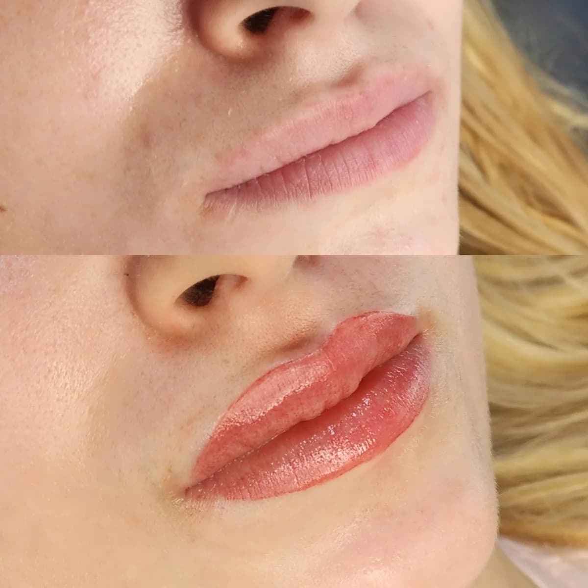 Before and after: Healed · Lip blush