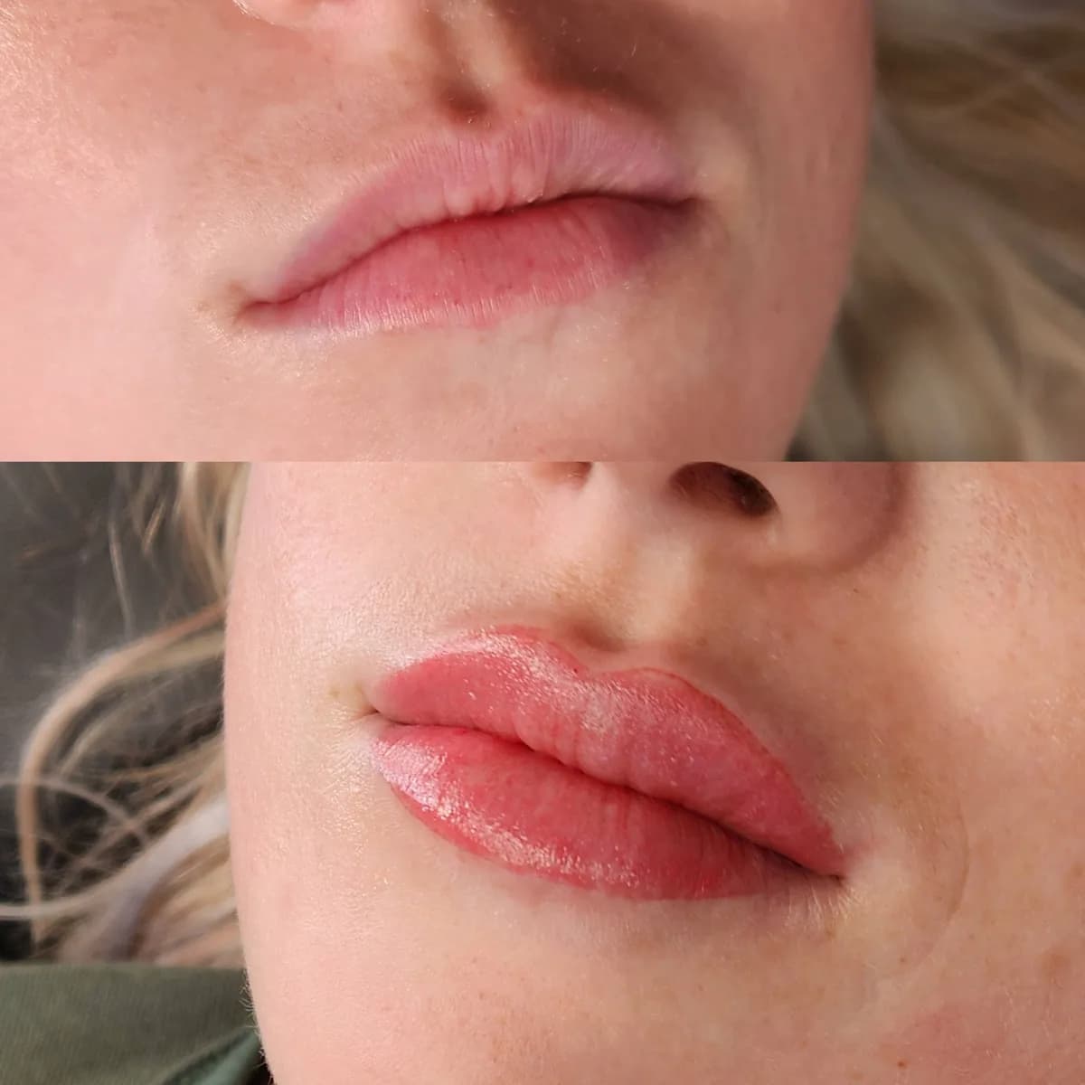 Before and after: Healed · Lip blush