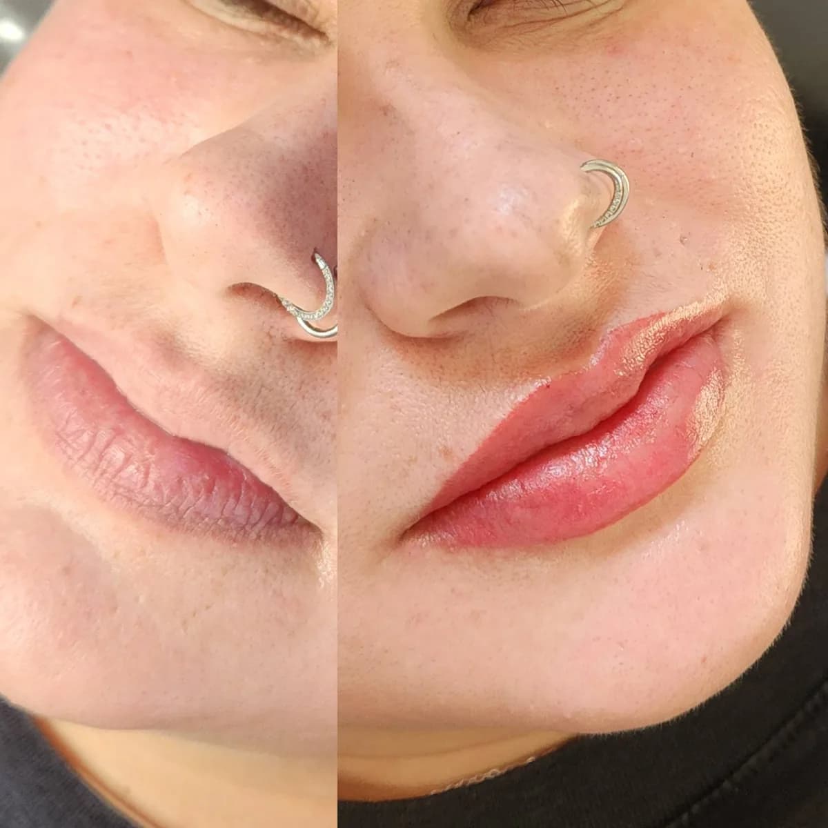 Before and after: Healed · Lip blush