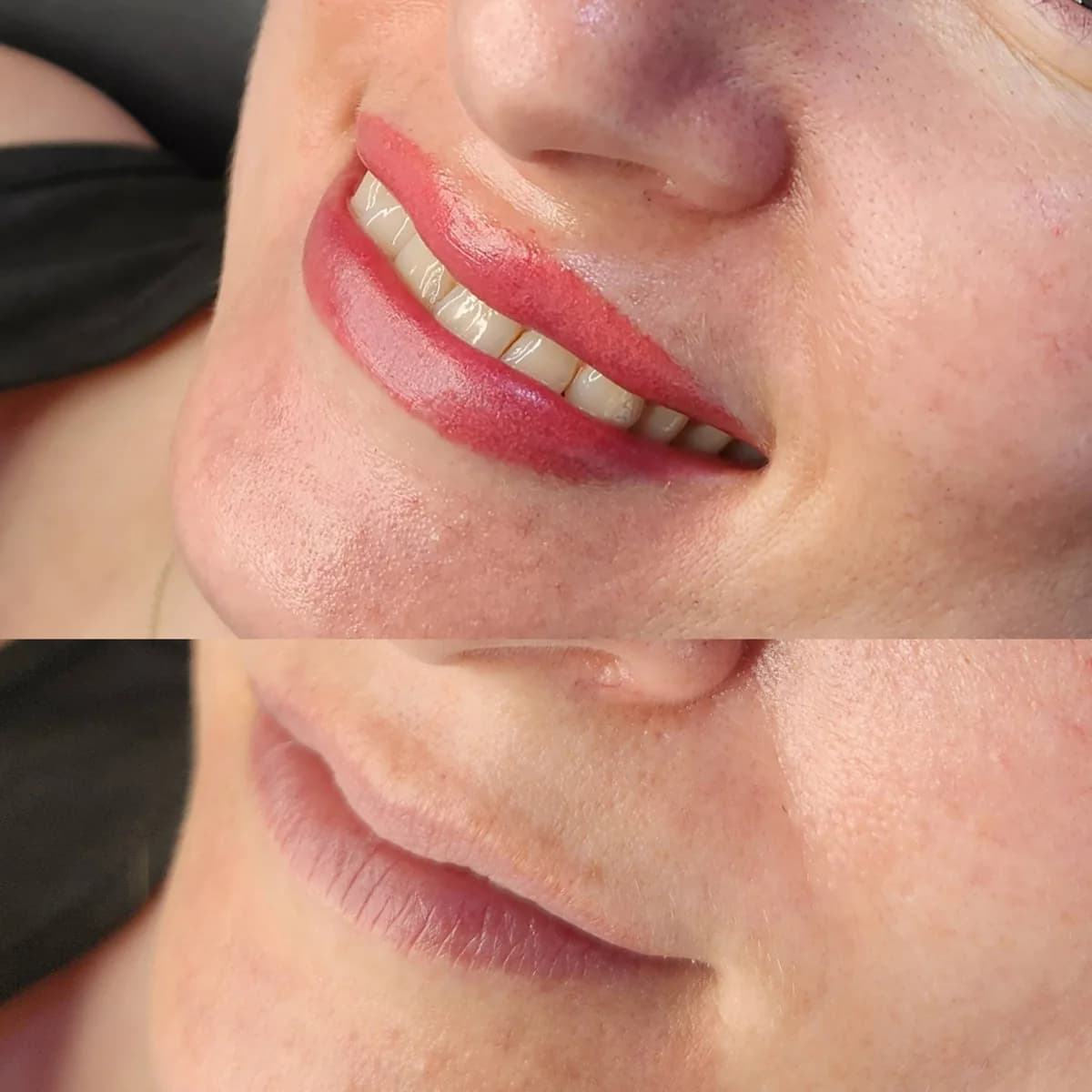 Before and after: Healed · Lip blush